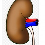 large kidney stones
