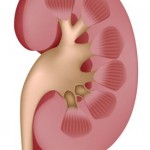 small kidney stones treatment